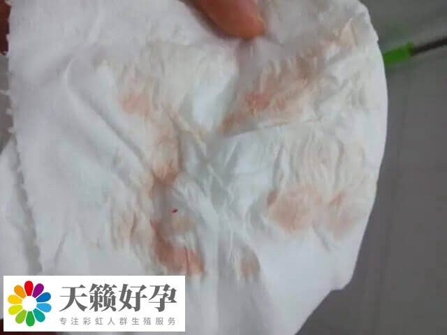 試管移植后出血要注意觀察