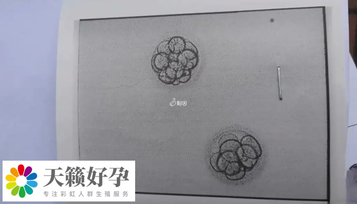 移植凍胚和自然懷孕測出時(shí)間不一樣