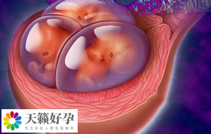 植入多個(gè)胚胎可能會(huì)導(dǎo)致多胎妊娠