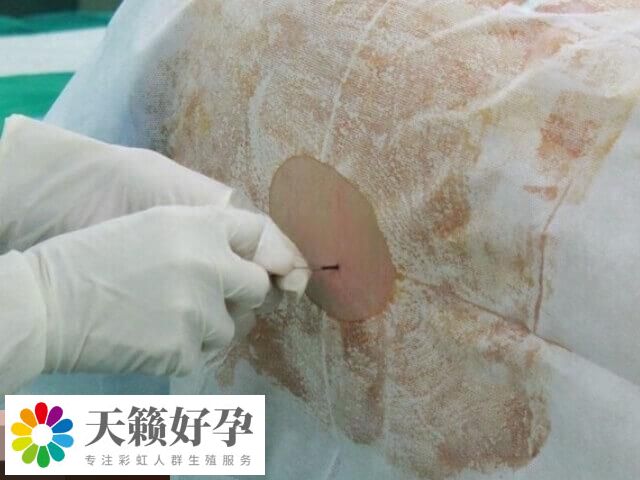 宮腔鏡是一種微創(chuàng)性婦科診療技術(shù)