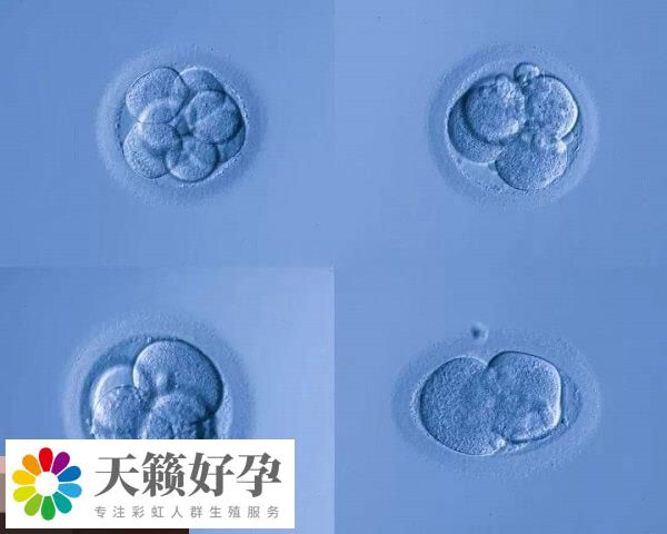 養囊可以提高試管移植成功率
