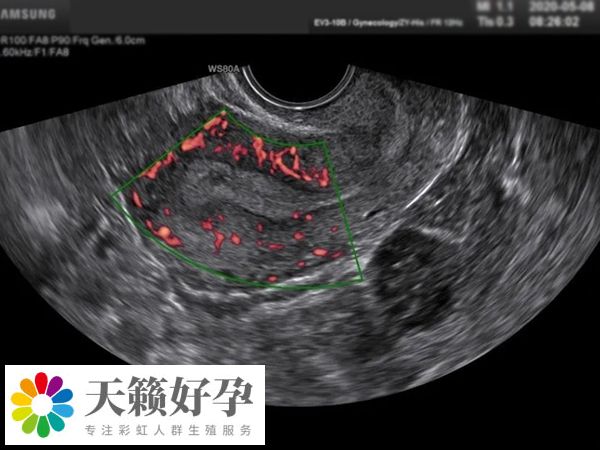 男性需要進(jìn)行睪丸超聲檢查