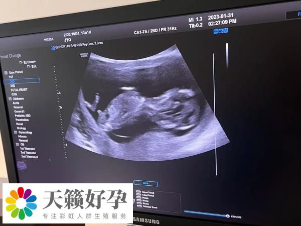 凍囊胚什么時候移植好看情況，具體得看月經是否正常
